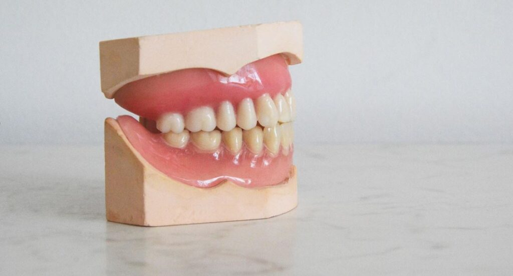 teeth whitening service perfect teeth