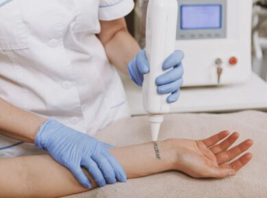 Tattoo Removal, Types Of Tattoo Removal